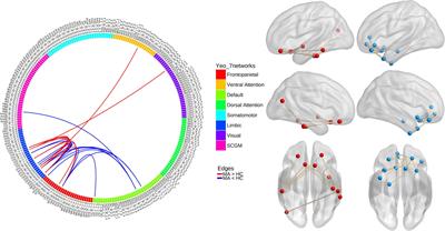 Abnormal resting-state functional connectome in methamphetamine-dependent patients and its application in machine-learning-based classification